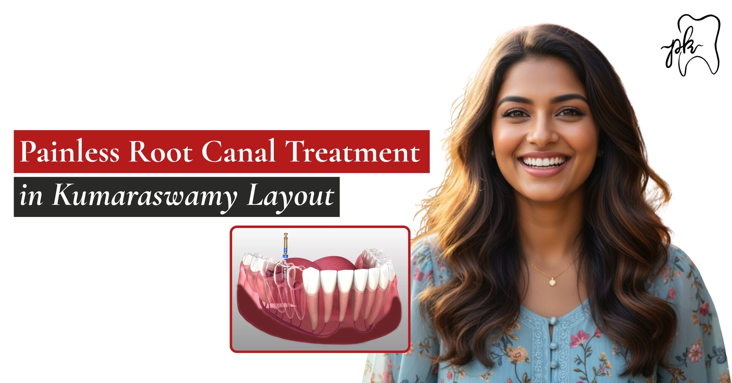 Painless Root Canal Treatment in Kumaraswamy Layout – Dr PK Dental Arbor