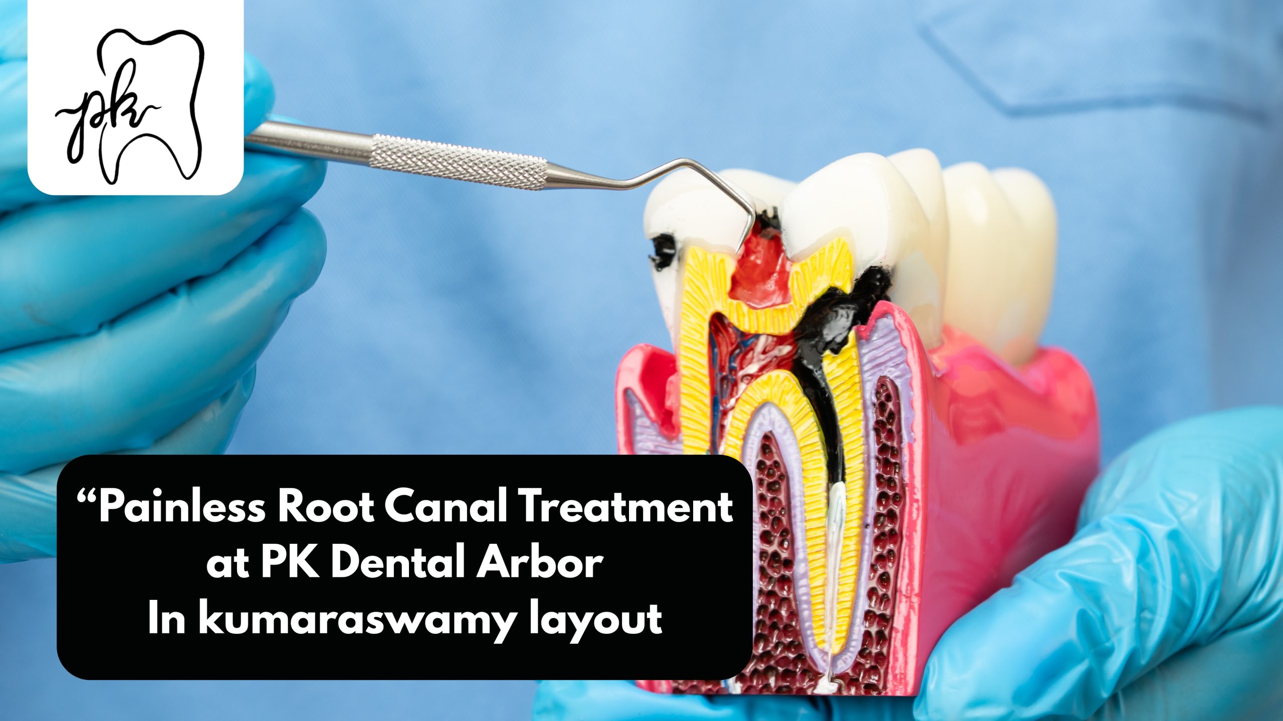 Painless Root Canal Treatment at PK Dental Arbor in Kumaraswamy Layout
