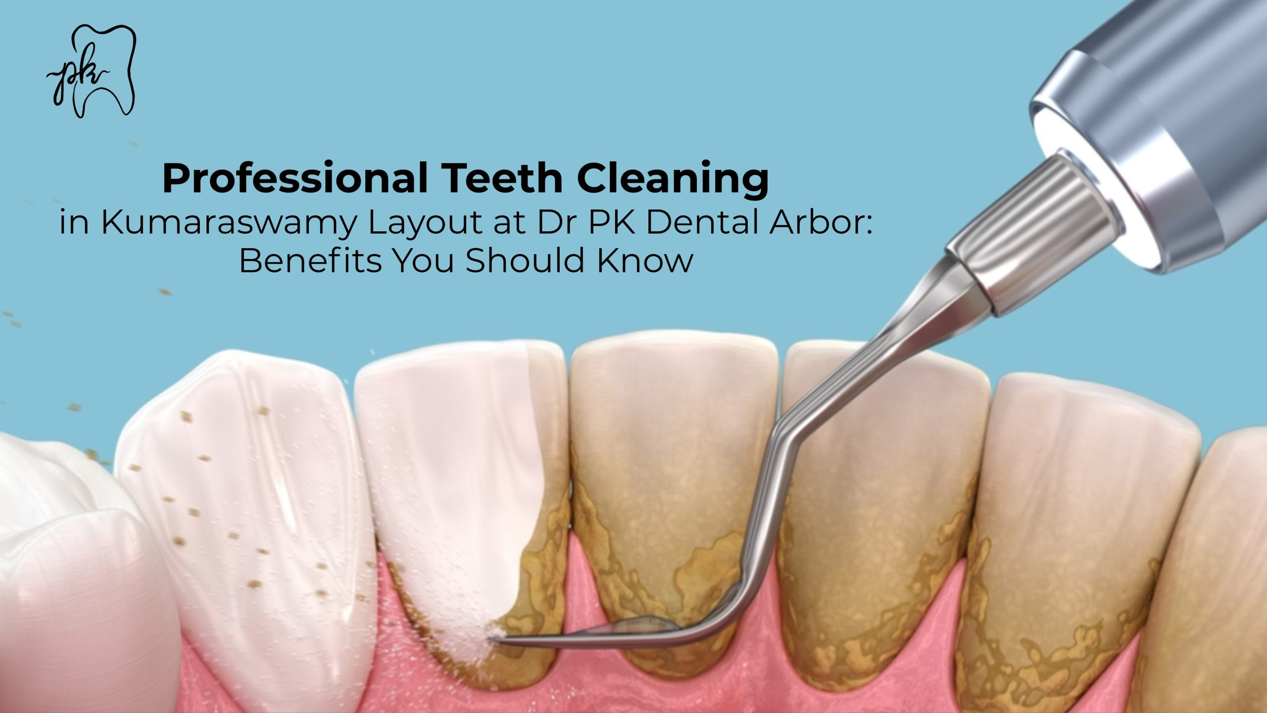 Professional Teeth Cleaning in Kumaraswamy Layout at Dr PK Dental Arbor: Benefits You Should Know