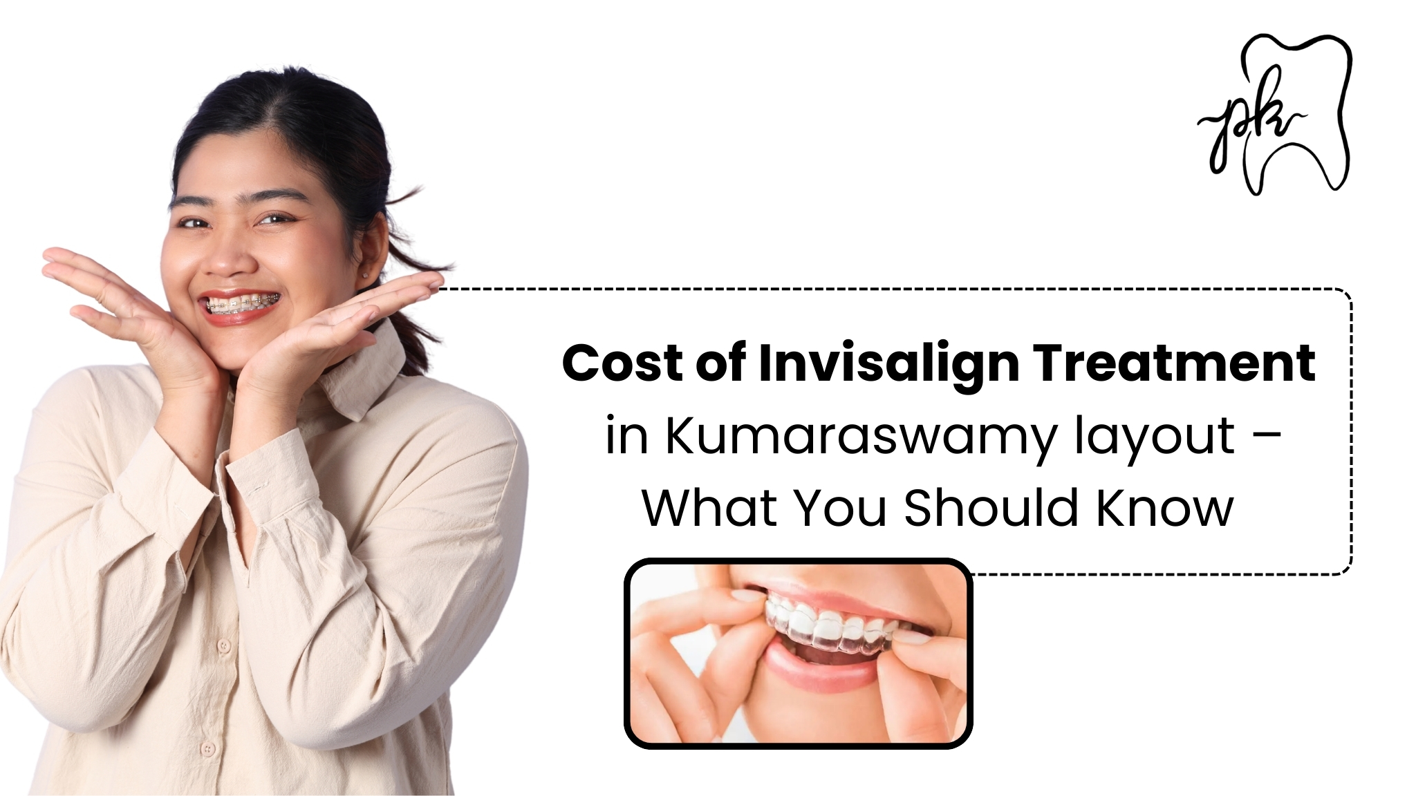 Cost of Invisalign Treatment in Kumaraswamy Layout – What You Should Know