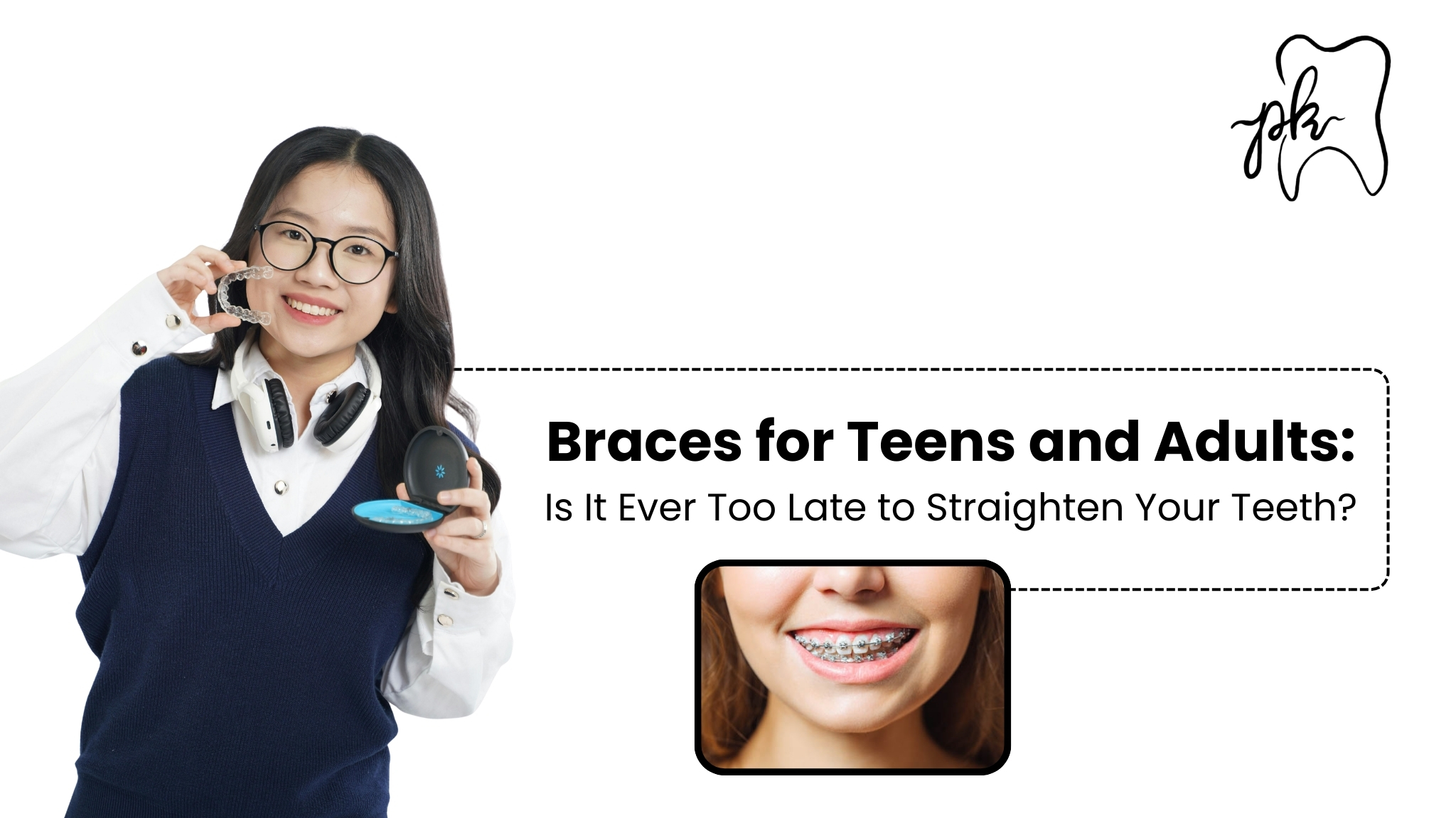 Braces for Teens and Adults: Is It Ever Too Late to Straighten Your Teeth?
