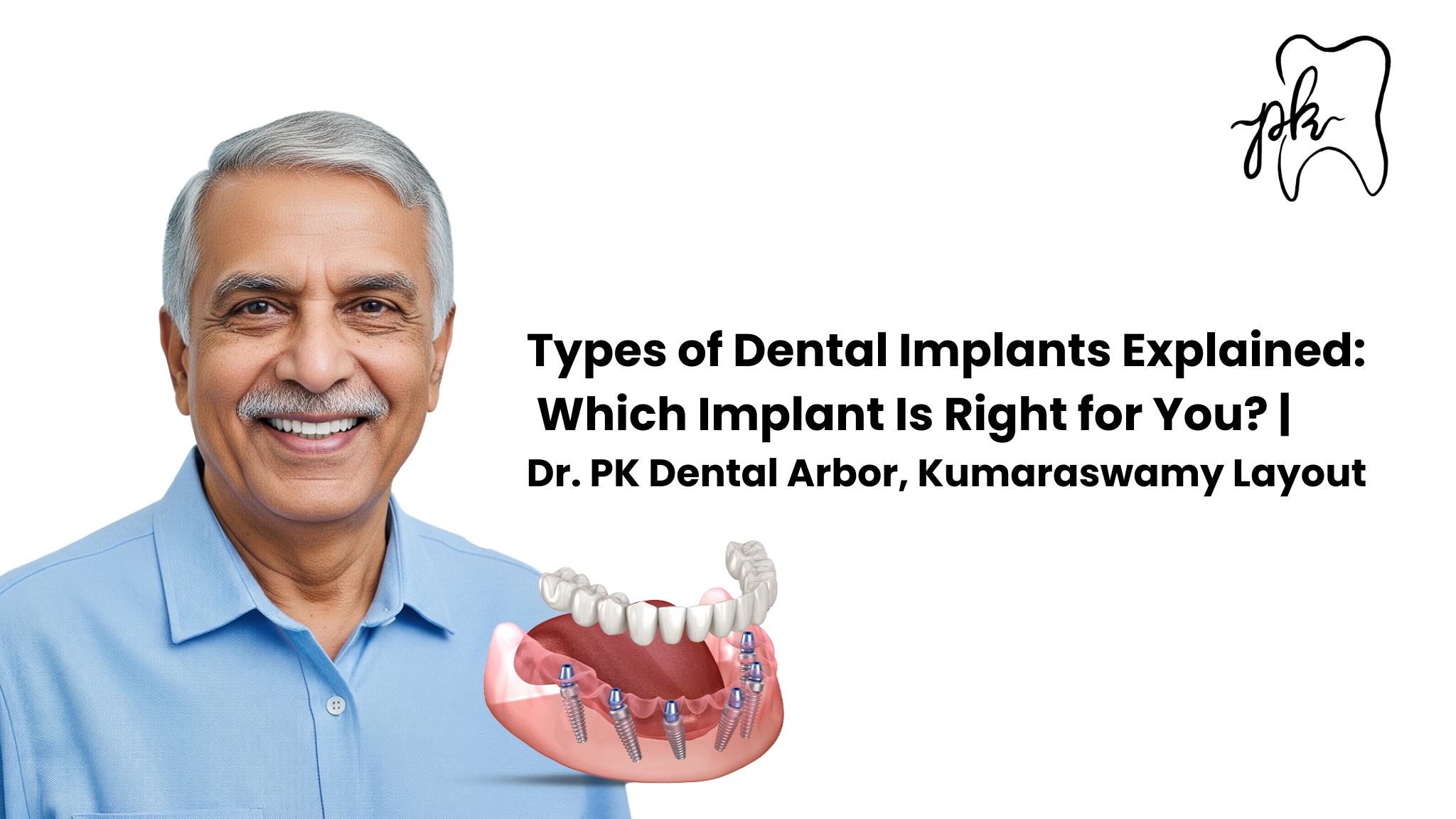 Types of Dental Implants Explained: Which Implant Is Right for You?