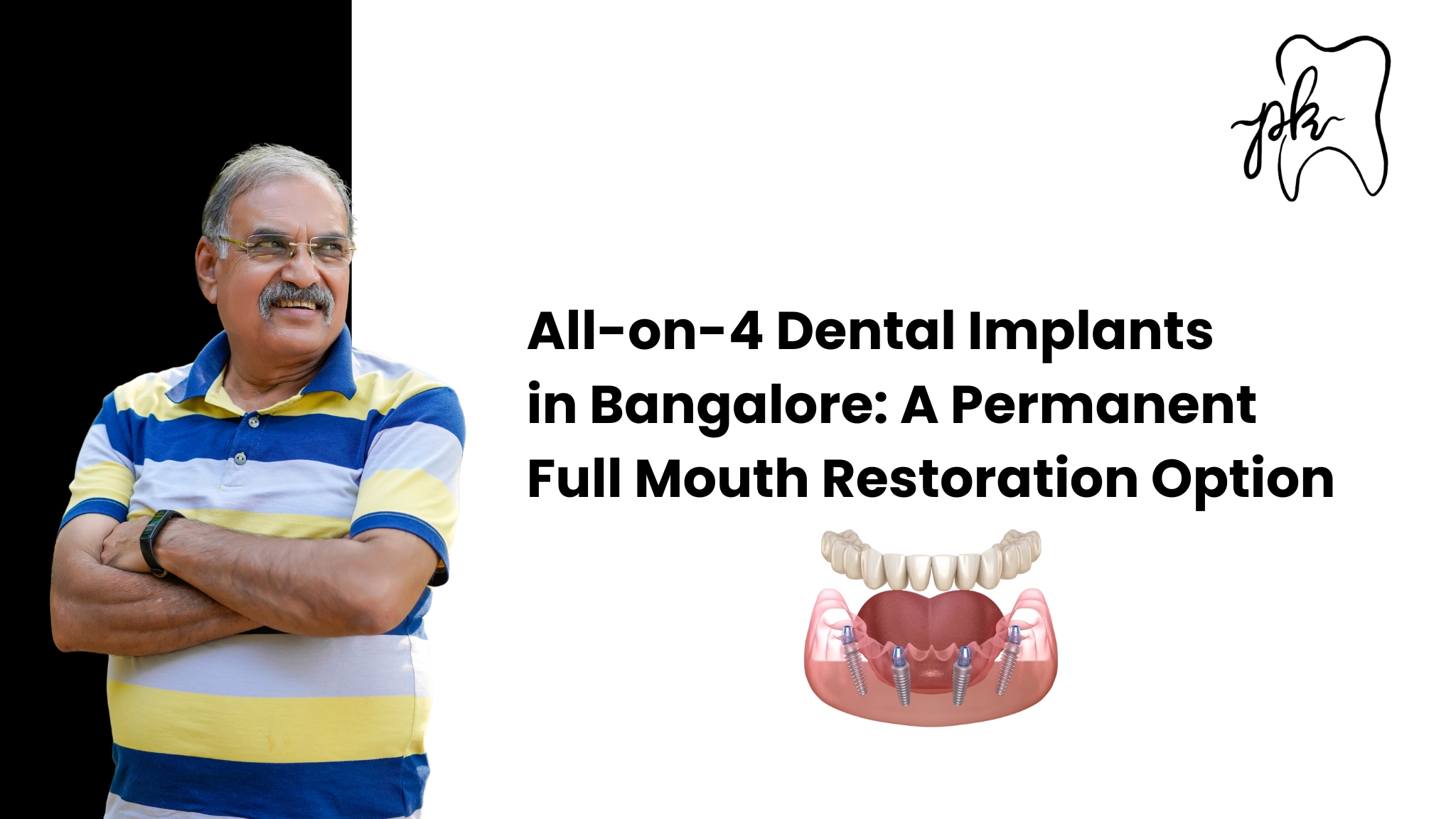 All-on-4 Dental Implants in Bangalore: A Permanent Full Mouth Restoration Option