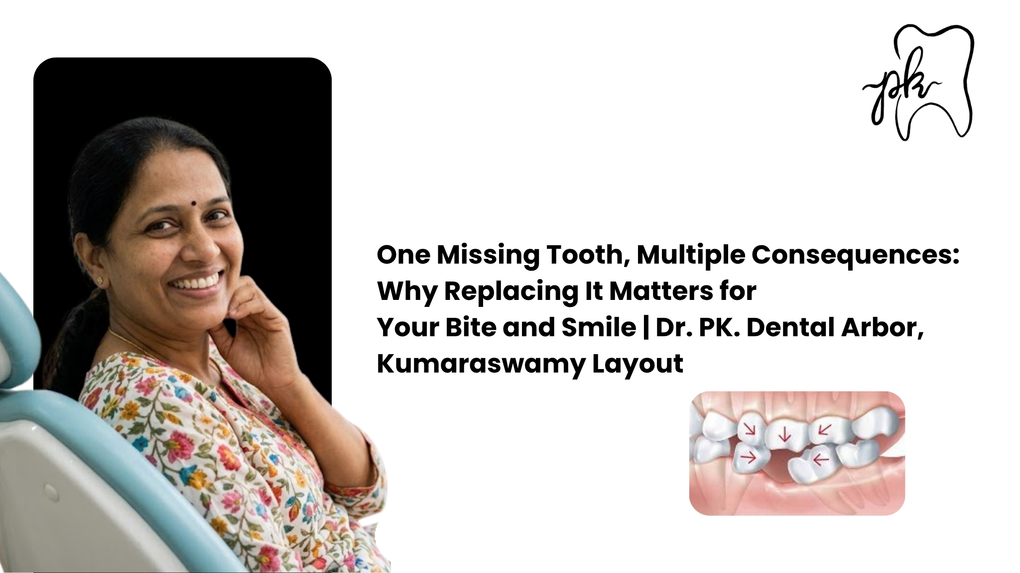 One Missing Tooth, Multiple Consequences: Why Replacing It Matters for Your Bite and Smile | Dr. PK Dental Arbor, Kumaraswamy Layout